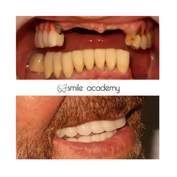 Slider image (2) Esthetic Smile Academy 